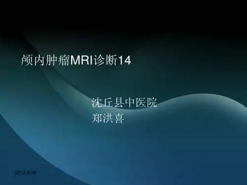 颅内肿瘤MRI诊断14