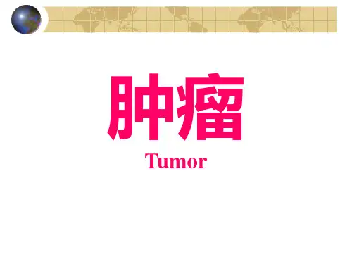 外科讲稿:肿瘤
