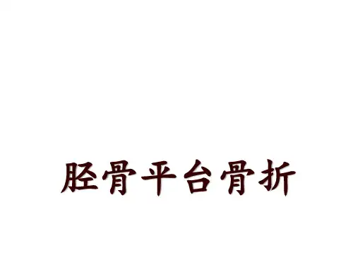 胫骨平台骨折
