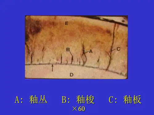 牙本质牙髓牙骨质课件!!!