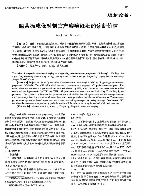 磁共振成像对剖宫产瘢痕妊娠的诊断价值