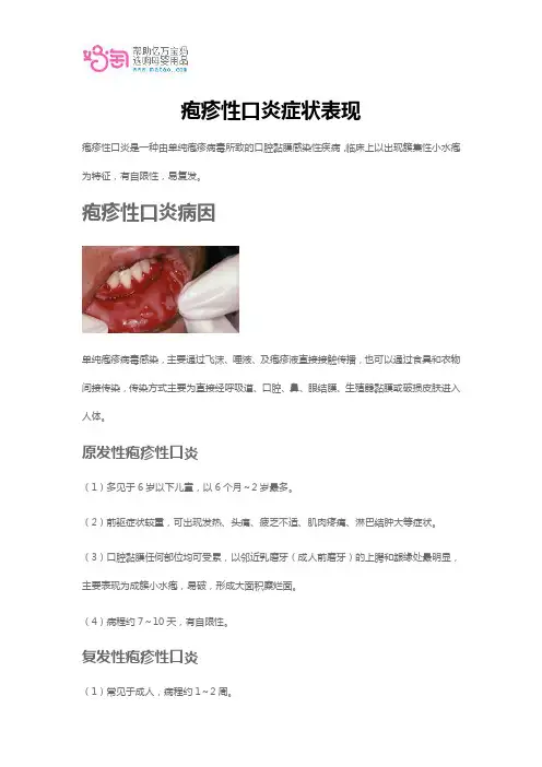 疱疹性口炎症状表现