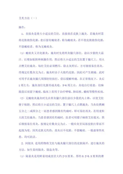 艾炙方法
