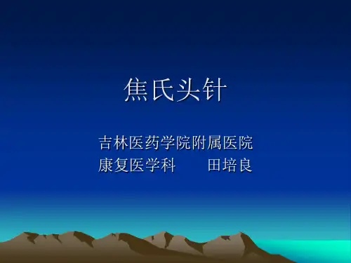 焦氏头针1