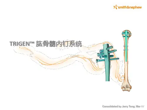 肱骨近端髓内钉汇总.