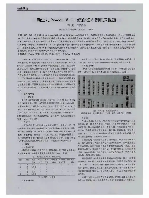 新生儿Prader-Willi综合征5例临床报道