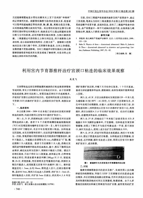 利用宫内节育器推杆治疗宫颈口粘连的临床效果观察