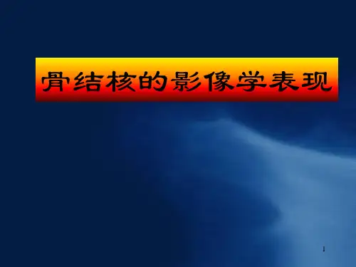(医学课件)骨结核的影像学表现