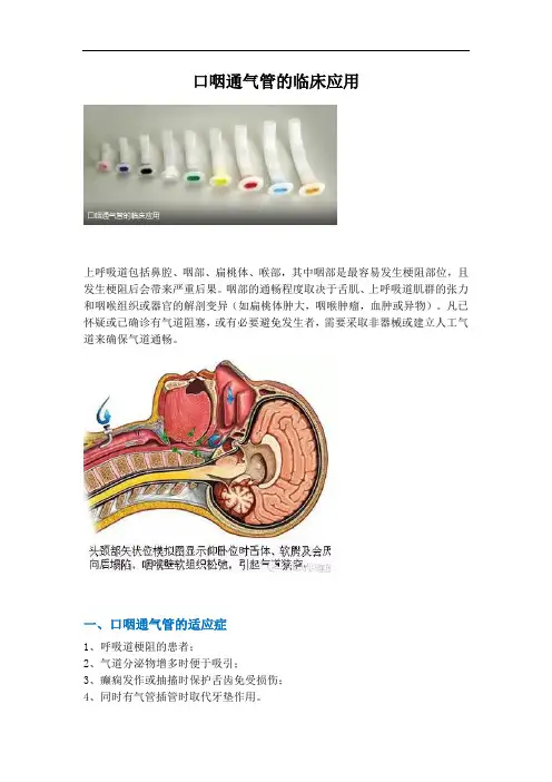 口咽通气管的临床应用
