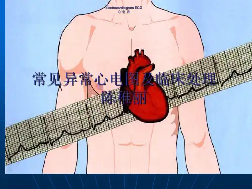 常见异常心电图及临床处理.