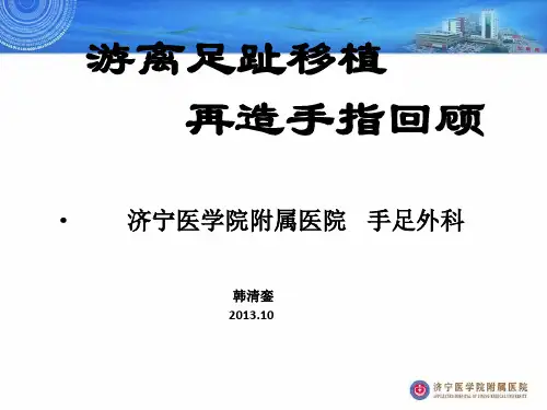 游离足趾移植再造手指回顾