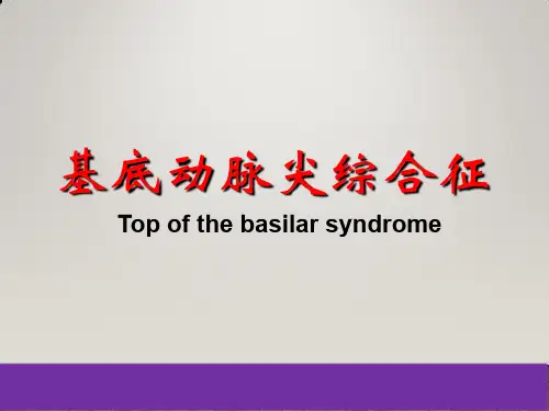 基底动脉尖综合征(业务学习)