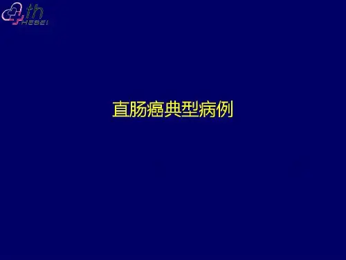 结肠癌典型病例讨论一例共36页文档