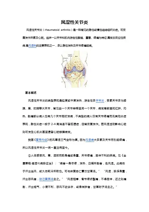 风湿性关节炎