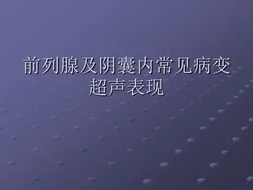 前列腺等超声诊断