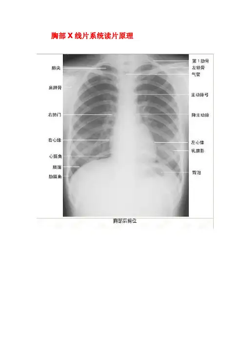 胸部X线片系统读片原理+,24个字母(A-X)系统读片法
