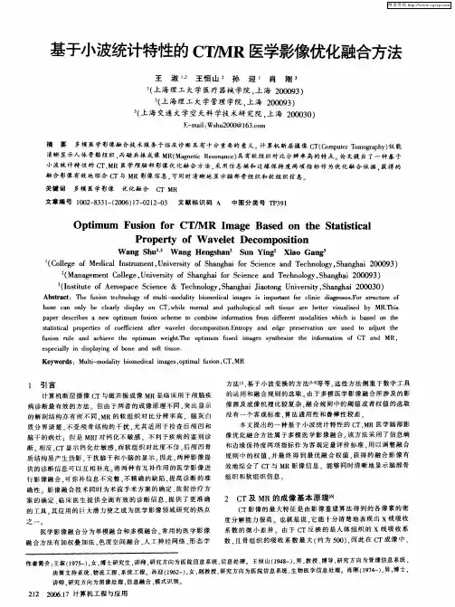 基于小波统计特性的CT／MR医学影像优化融合方法