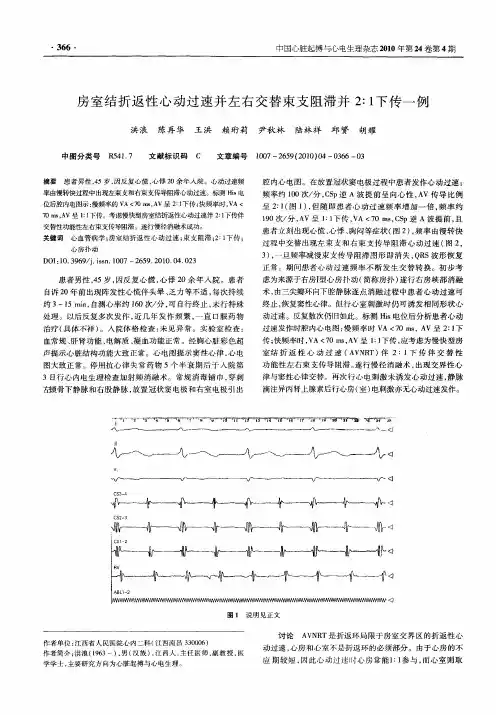 房室结折返性心动过速并左右交替束支阻滞并2：1下传一例