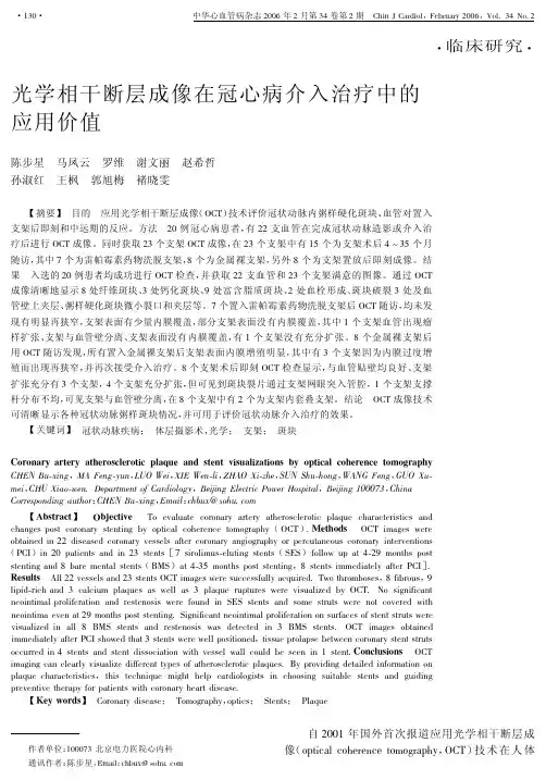OCT在冠心病介入治疗中