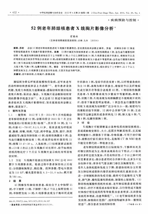 52例老年肺结核患者X线胸片影像分析