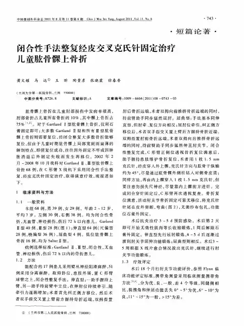 闭合性手法整复经皮交叉克氏针固定治疗儿童肱骨髁上骨折