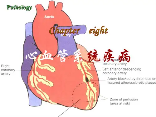 病理学-第八章   心血管系统疾病 PPT精品课件