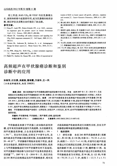高频超声在甲状腺癌诊断和鉴别诊断中的应用
