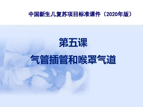 5气管插管和喉罩气道_新生儿复苏标准课件2020年版
