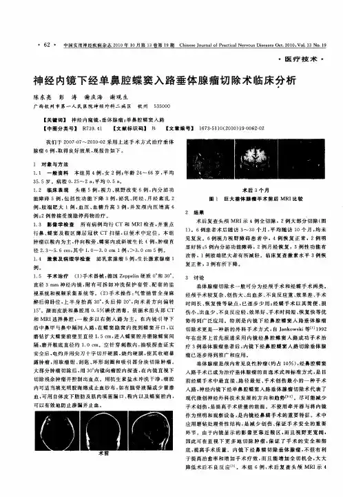 神经内镜下经单鼻腔蝶窦入路垂体腺瘤切除术临床分析