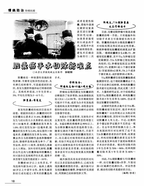 胆囊癌手术切除新观点