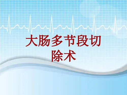 手术讲解模板：大肠多节段切除术