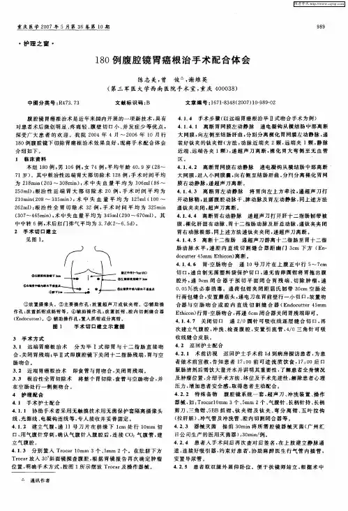 180例腹腔镜胃癌根治手术配合体会