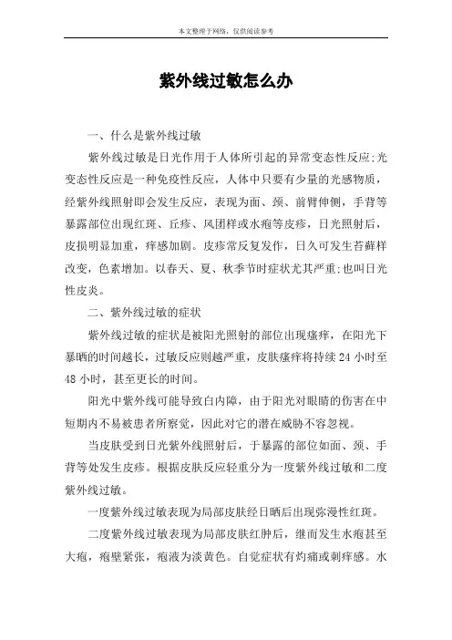 紫外线过敏怎么办