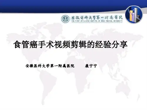 视频剪辑的经验分享