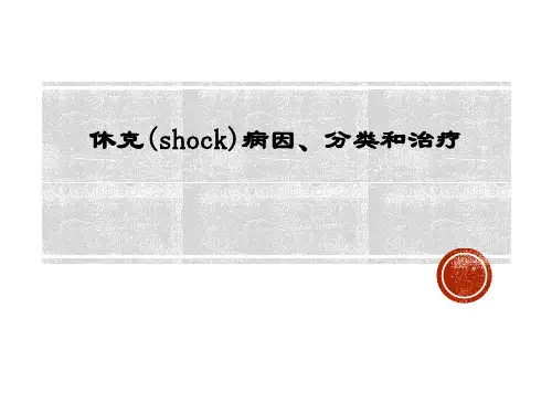 休克(shock)病因、分类和治疗
