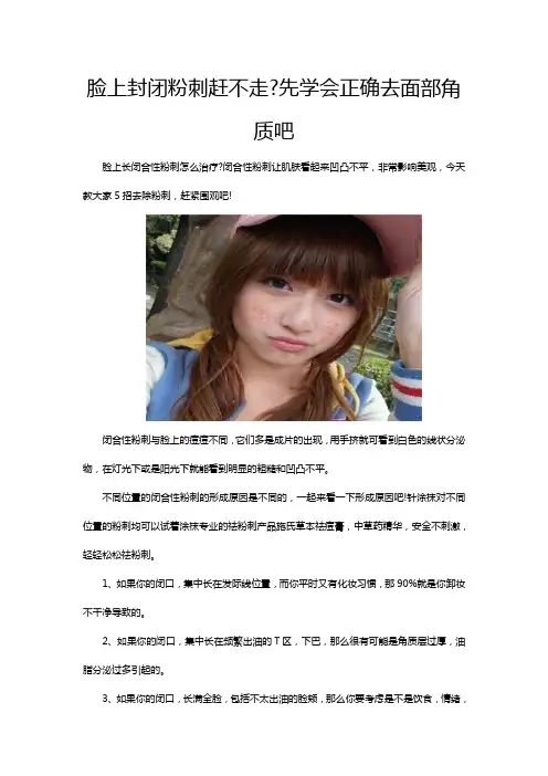脸上封闭粉刺赶不走先学会正确去面部角质吧