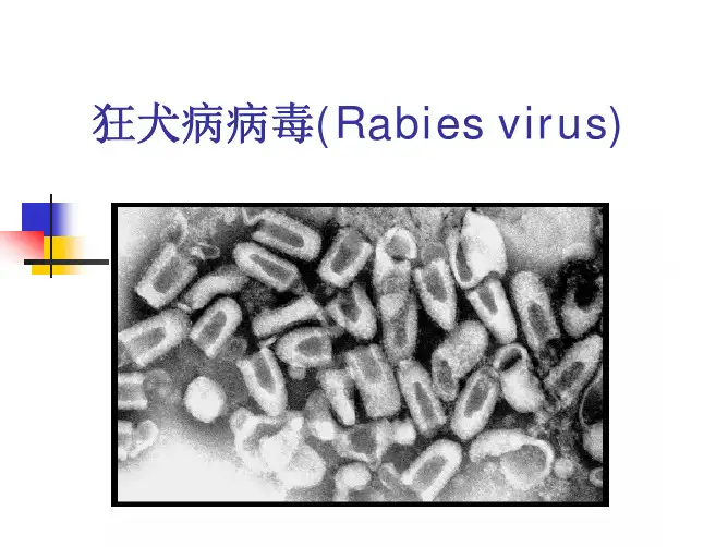 医学微生物学(山东大学)~32 其他病毒