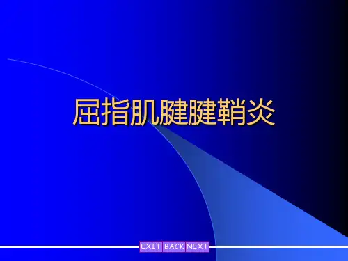 屈指肌腱腱鞘炎