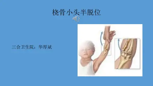 桡骨小头半脱位PPT课件