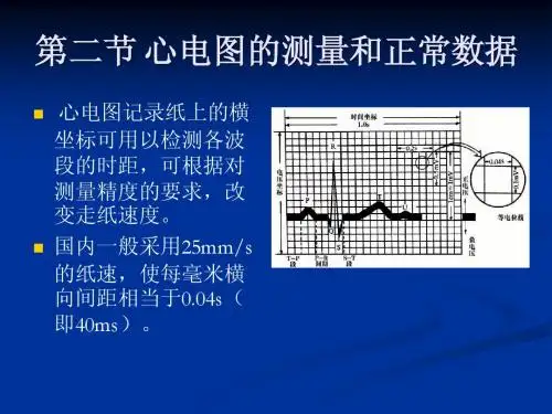 心电图基础 第二章