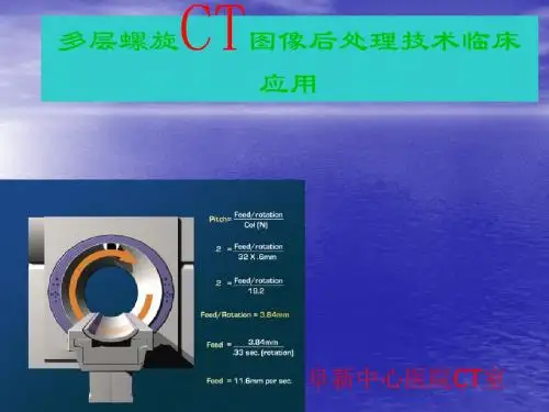 多层螺旋CT图像后处理技术临床应用