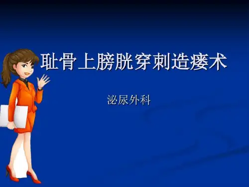 耻骨上膀胱穿刺造瘘术ppt课件21页PPT