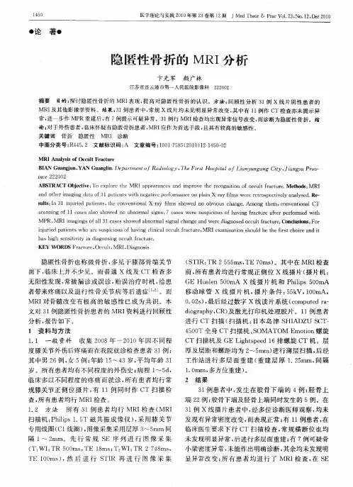 隐匿性骨折的MRI分析