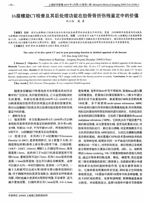 16层螺旋CT检查及其后处理功能在肋骨骨折伤残鉴定中的价值