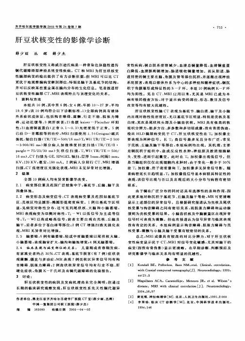 肝豆状核变性的影像学诊断