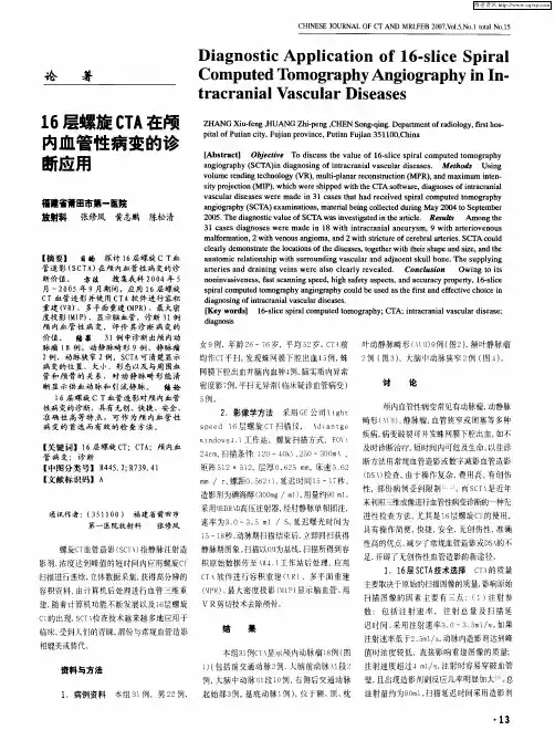 16层螺旋CTA在颅内血管性病变的诊断应用