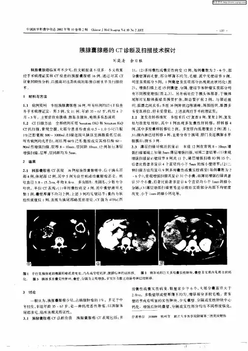 胰腺囊腺癌的CT诊断及扫描技术探讨