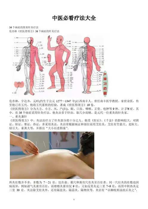 中医必看疗法大全56个病症的简易针灸疗法