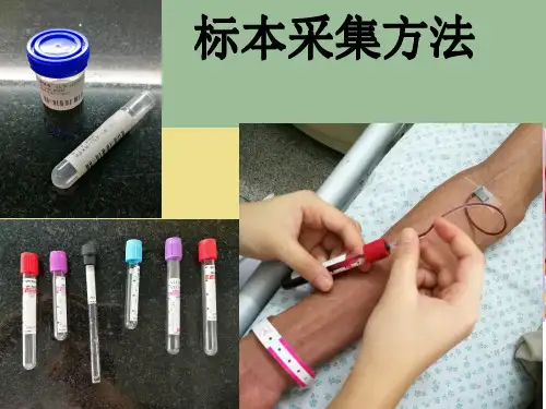 标本采集法