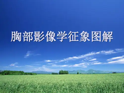 胸部影像学征象图解